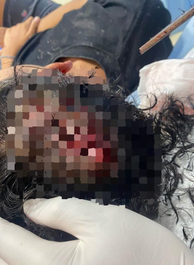 
 Aktivis Mendesak Polsek Citeureup Usut Tuntas Kasus Dugaan Penganiayaan, Kepala Digetok Airsoftgun 